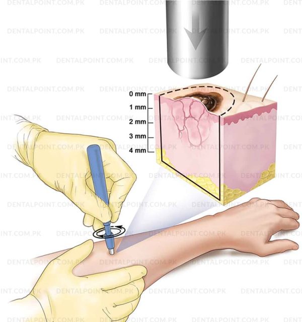 Disposable Biopsy Punch Set of 3 any sizes - Doctor Shop